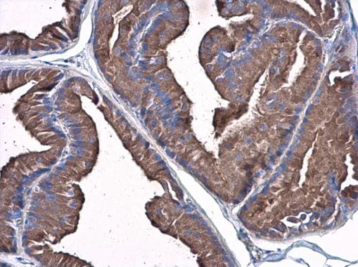 Plasminogen Antibody (PA5-34677)