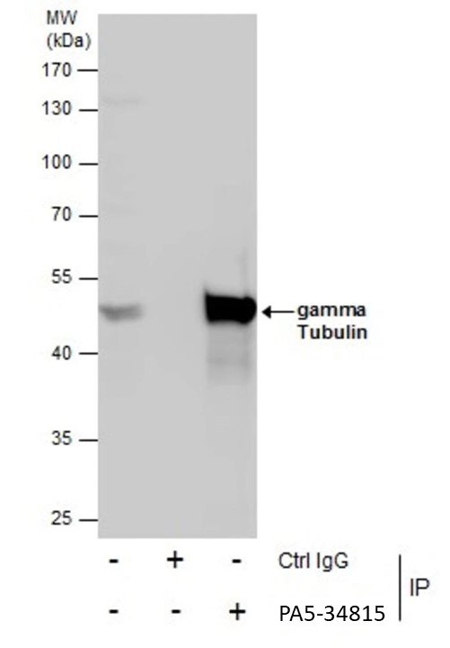 gamma Tubulin Antibody in Immunoprecipitation (IP)