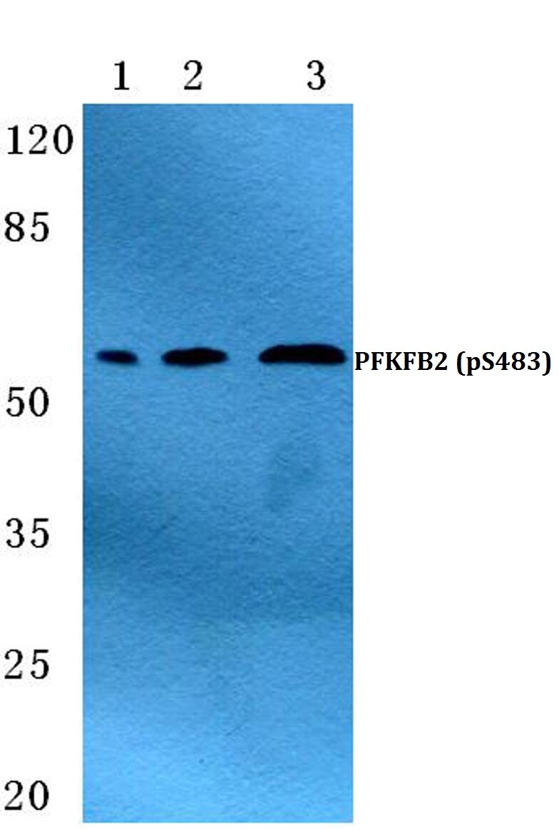 Phospho-PFKFB2 (Ser483) Antibody in Western Blot (WB)