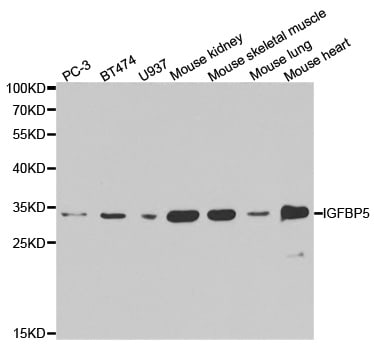 Igfbp5 Antibody Pa5 37369