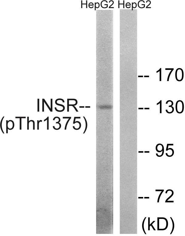 Phospho-INSR (Thr1375) Antibody in Western Blot (WB)