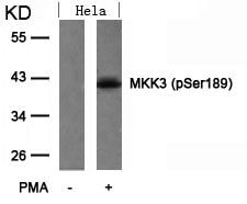 Phospho-MEK3 (Ser189) Antibody in Western Blot (WB)