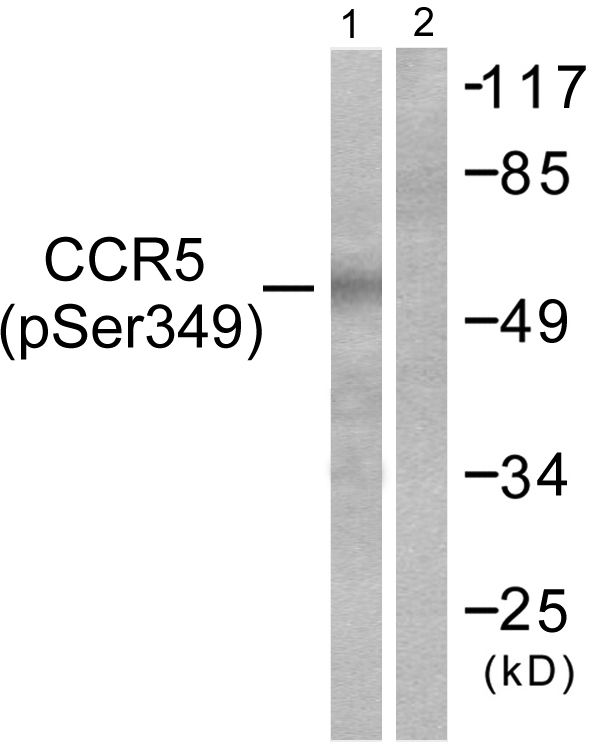 Anti-CCR5 Antibodies | Invitrogen