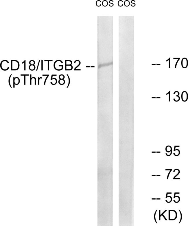 Phospho-CD18 (Thr758) Antibody in Western Blot (WB)