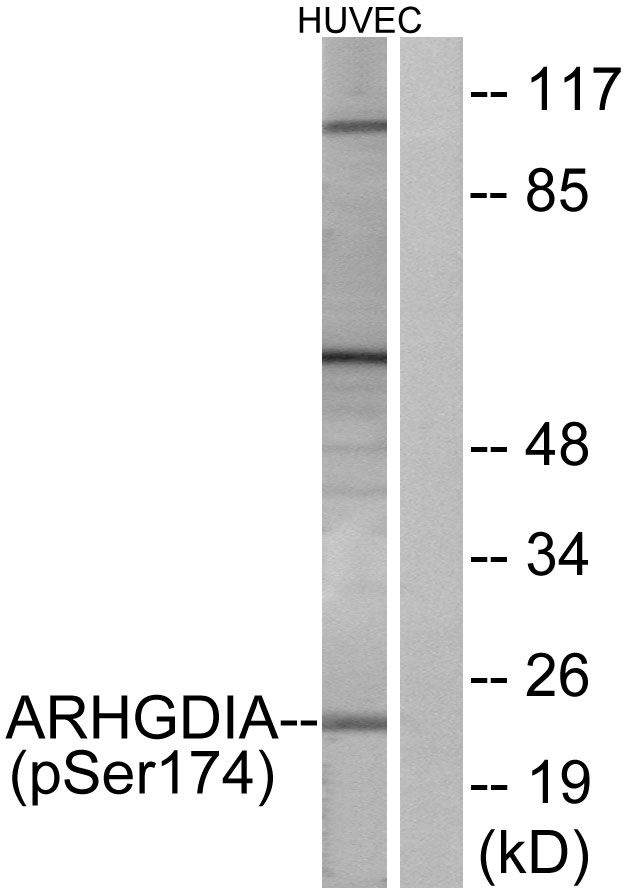 Phospho-RhoGDI (Ser174) Antibody in Western Blot (WB)