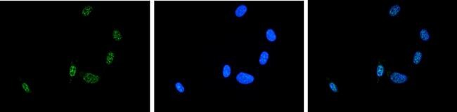 ASH2L Antibody in Immunocytochemistry (ICC/IF)