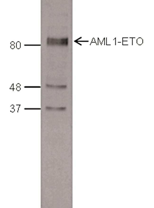 RUNX1/RUNX1T1 Antibody in Western Blot (WB)