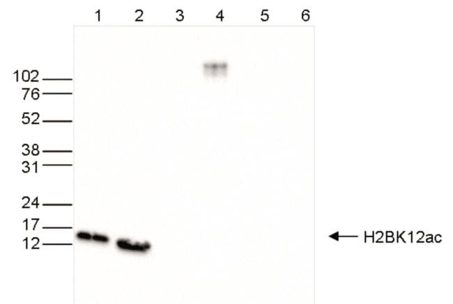 H2BK12ac Antibody in Western Blot (WB)