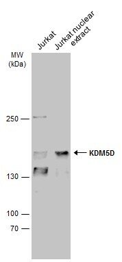 KDM5D Antibody in Western Blot (WB)