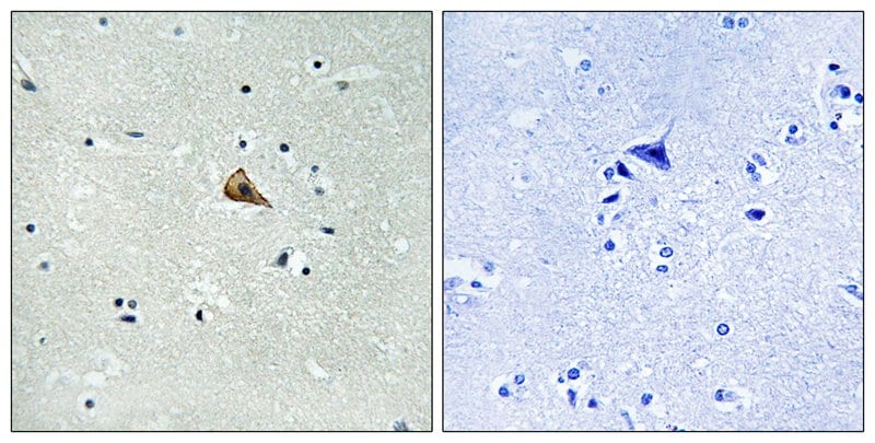 Phospho-TrkA (Tyr701) Antibody in Immunohistochemistry (Paraffin) (IHC (P))