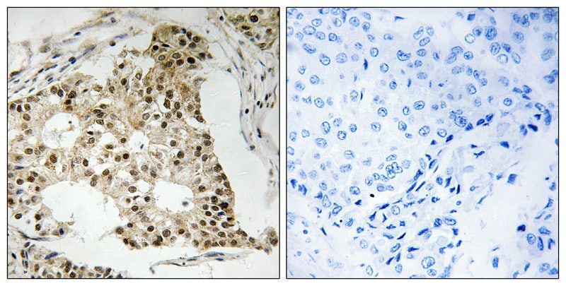 Phospho-RARA (Ser77) Antibody in Immunohistochemistry (Paraffin) (IHC (P))