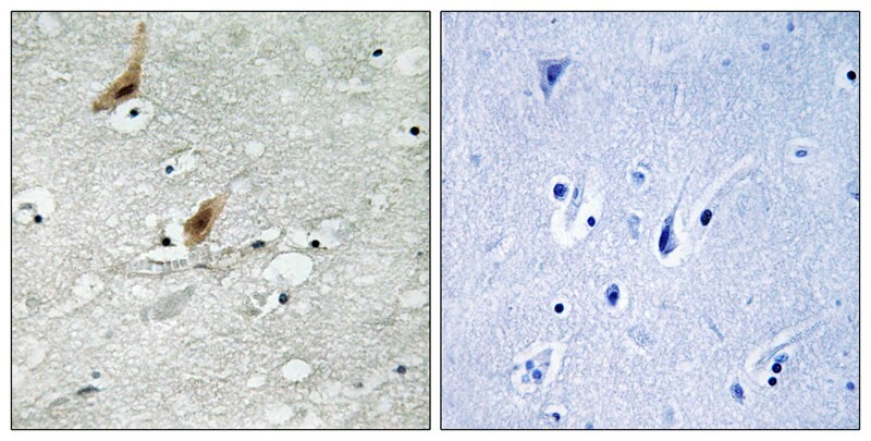 Phospho-MSK2 (Thr568) Antibody in Immunohistochemistry (Paraffin) (IHC (P))