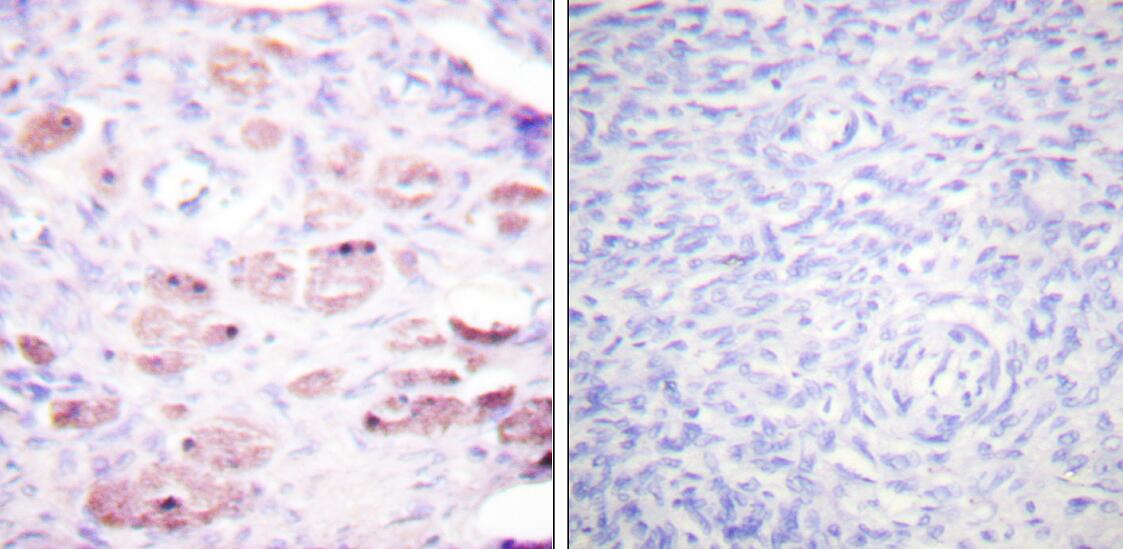 Phospho-DAXX (Ser668) Antibody in Immunohistochemistry (Paraffin) (IHC (P))