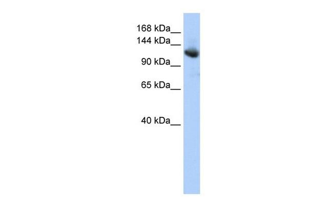 CAND1 Antibody in Western Blot (WB)
