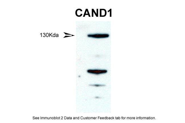 CAND1 Antibody in Western Blot (WB)