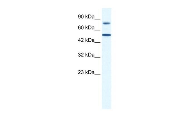 ZNF223 Antibody in Western Blot (WB)