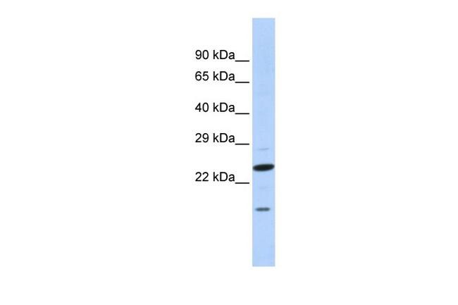 INSIG2 Antibody (PA5-41707)