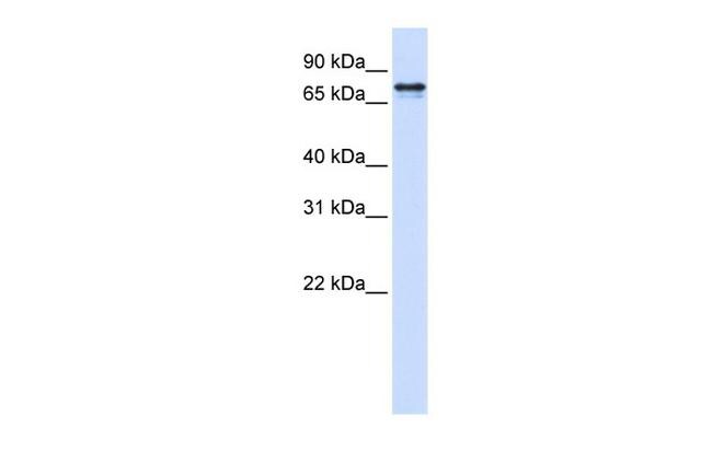 SRP68 Antibody in Western Blot (WB)
