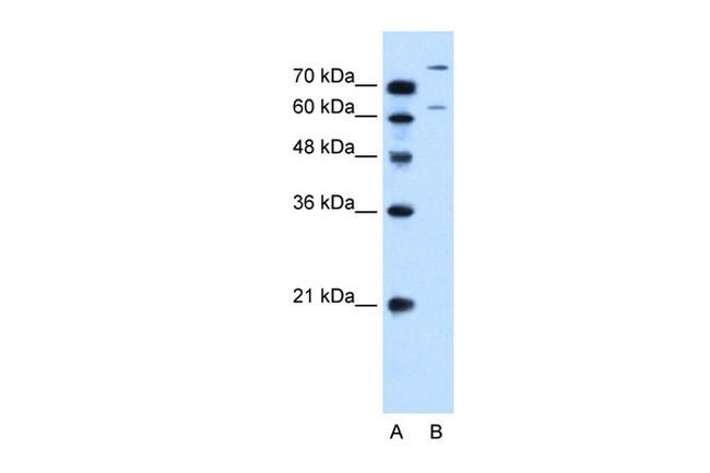 SLC26A1 Antibody in Western Blot (WB)