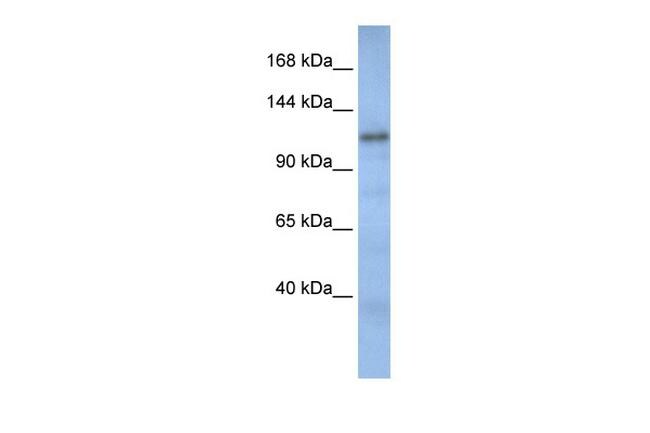 CAND2 Antibody in Western Blot (WB)