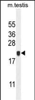 C4orf46 Antibody in Western Blot (WB)