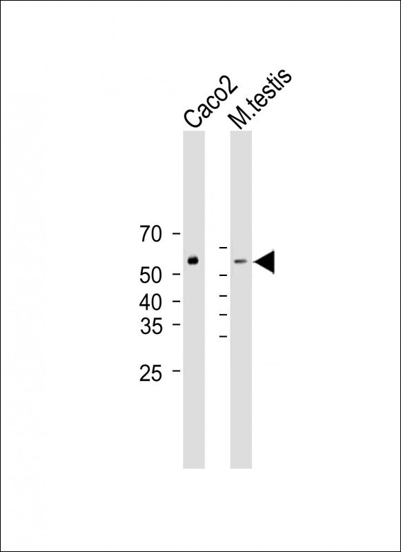 DHCR7 Antibody in Western Blot (WB)
