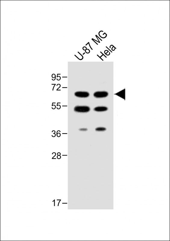 UGT8 Antibody in Western Blot (WB)