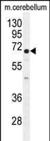 UGT8 Antibody in Western Blot (WB)