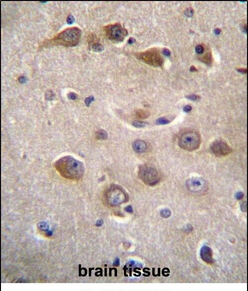 RAB40AL Antibody in Immunohistochemistry (Paraffin) (IHC (P))