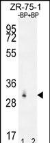 RAB40AL Antibody in Western Blot (WB)