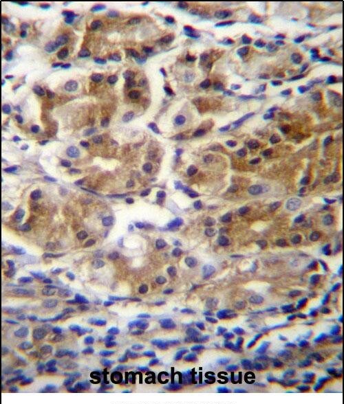 PDPR Antibody in Immunohistochemistry (Paraffin) (IHC (P))