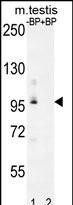 PDPR Antibody in Western Blot (WB)