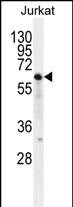 Naked2 Antibody in Western Blot (WB)