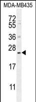 FAM109A Antibody in Western Blot (WB)
