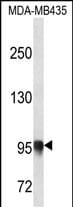 PLOD3 Antibody in Western Blot (WB)