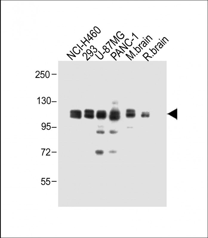 XYLT1 Antibody in Western Blot (WB)