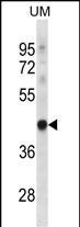 TRUB1 Antibody in Western Blot (WB)