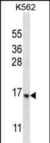 STARD5 Antibody in Western Blot (WB)