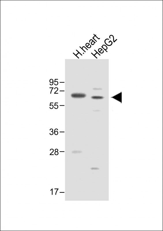 ASPG Antibody in Western Blot (WB)