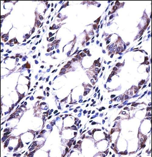 HRASLS5 Antibody in Immunohistochemistry (Paraffin) (IHC (P))