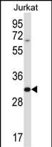 HRASLS5 Antibody in Western Blot (WB)