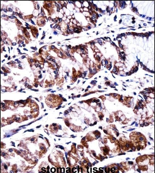 PPEF2 Antibody in Immunohistochemistry (Paraffin) (IHC (P))