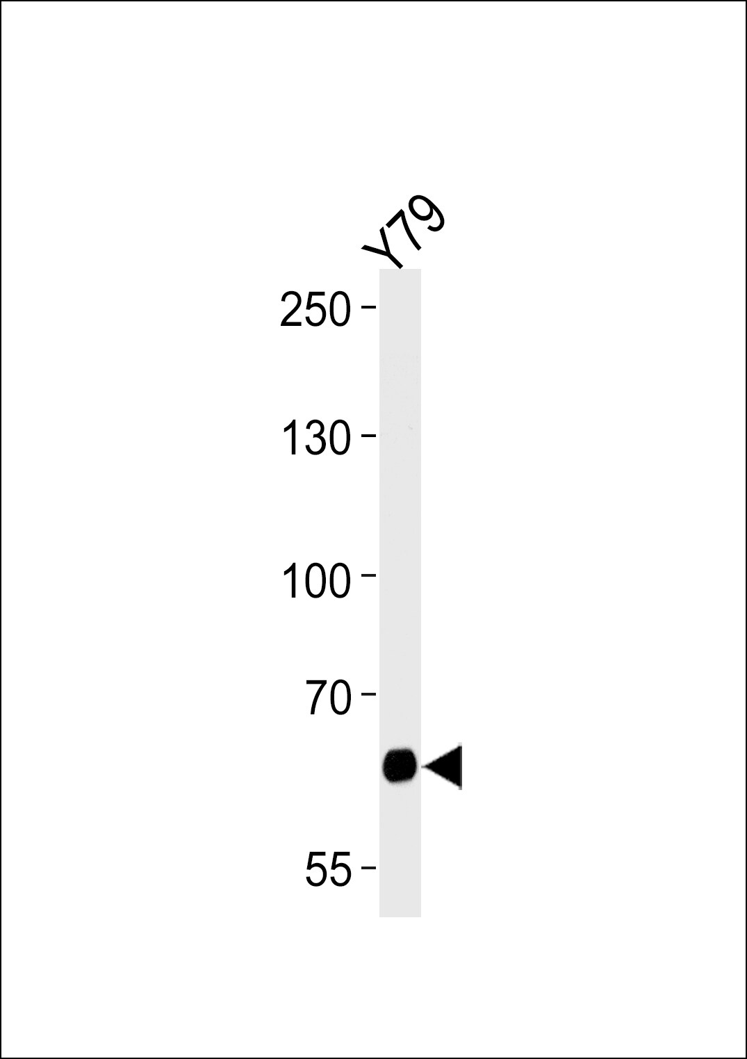 PPEF2 Antibody in Western Blot (WB)