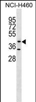 GLT8D1 Antibody in Western Blot (WB)