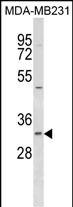 FAHD2B Antibody in Western Blot (WB)