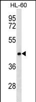 CLN8 Antibody in Western Blot (WB)