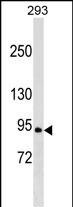 RALGDS Antibody in Western Blot (WB)