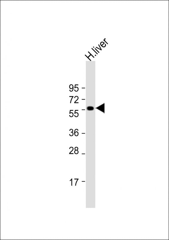 SLC30A10 Antibody in Western Blot (WB)