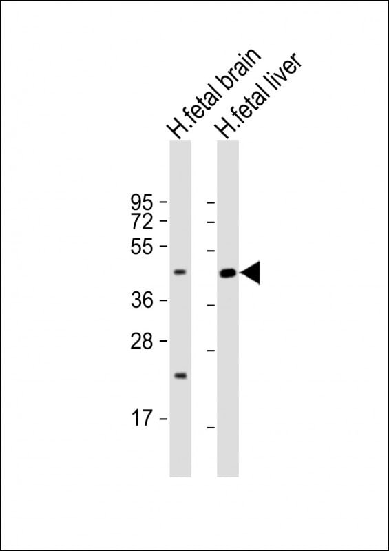 SLC30A10 Antibody in Western Blot (WB)