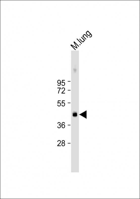 Urokinase Antibody in Western Blot (WB)